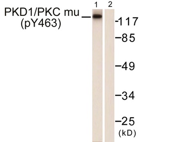 PKD1 (phospho Tyr463) rabbit pAb Antibody