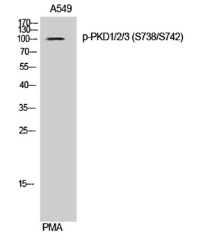 PKD1/2/3 (phospho Ser738/S742) rabbit pAb Antibody