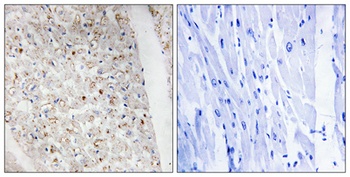 PKD1/2/3 (phospho Ser738/S742) rabbit pAb Antibody