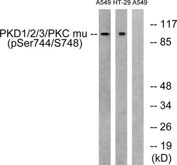 PKD1/2/3 (phospho Ser738/S742) rabbit pAb Antibody