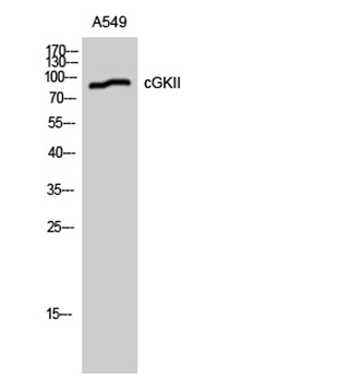 cGKII rabbit pAb Antibody