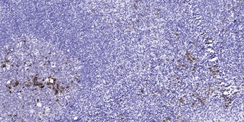 cGKII rabbit pAb Antibody