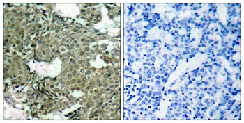 MEK-1/2 (phospho Ser222/226) rabbit pAb Antibody