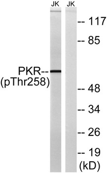 PKR (phospho Thr258) rabbit pAb Antibody