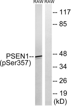 Presenilin 1 (phospho Ser357) rabbit pAb Antibody