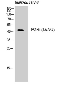 Presenilin 1 rabbit pAb Antibody