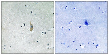 Presenilin 1 rabbit pAb Antibody