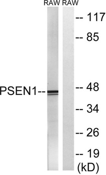 Presenilin 1 rabbit pAb Antibody