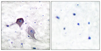 PS-1 rabbit pAb Antibody