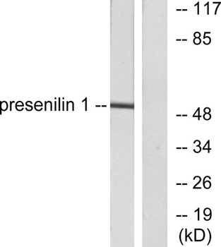 PS-1 rabbit pAb Antibody