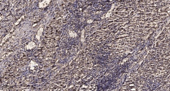 PSMC3 rabbit pAb Antibody
