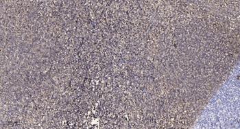 PSMD3 rabbit pAb Antibody