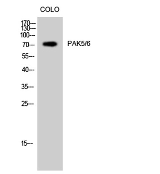 PAK5/6 rabbit pAb Antibody