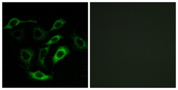 PD2R rabbit pAb Antibody