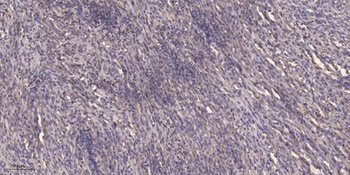NDRG2 rabbit pAb Antibody