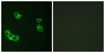 PTH/PTHrP-R rabbit pAb Antibody