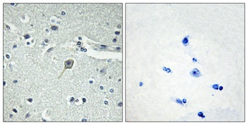 PTH/PTHrP-R rabbit pAb Antibody