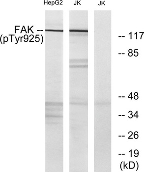 FAK (phospho Tyr925) rabbit pAb Antibody