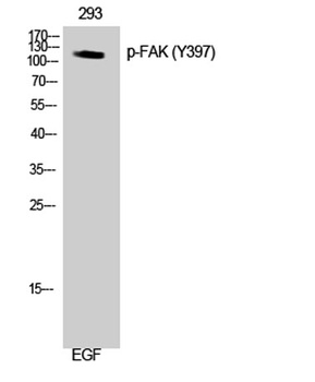 FAK (phospho Tyr397) rabbit pAb Antibody