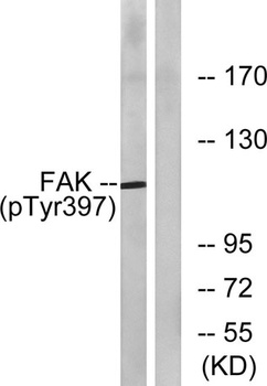 FAK (phospho Tyr397) rabbit pAb Antibody