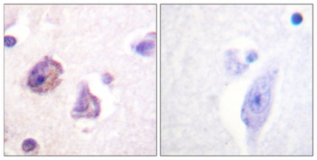 FAK (phospho Tyr576) rabbit pAb Antibody