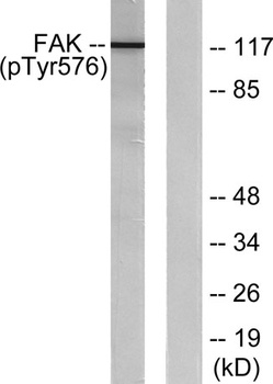 FAK (phospho Tyr576) rabbit pAb Antibody