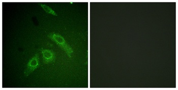 FAK (phospho Ser910) rabbit pAb Antibody