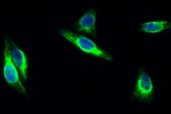 FAK rabbit pAb Antibody