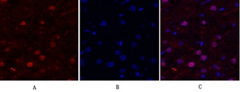 FAK rabbit pAb Antibody