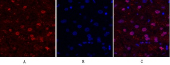 FAK rabbit pAb Antibody