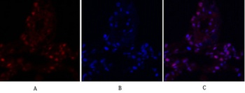 FAK rabbit pAb Antibody
