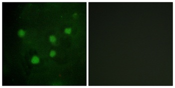 BAF250b rabbit pAb Antibody