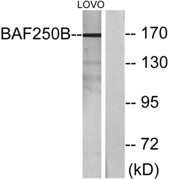 BAF250b rabbit pAb Antibody