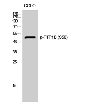 PTP1B (phospho Ser50) rabbit pAb Antibody