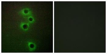 MARK4 rabbit pAb Antibody
