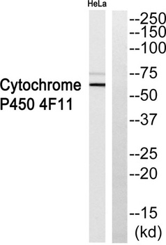 CYP4F11 rabbit pAb Antibody