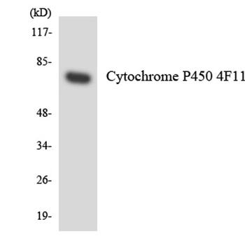 CYP4F11 rabbit pAb Antibody