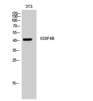 IGSF4B rabbit pAb Antibody