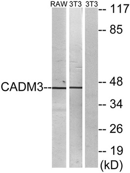 IGSF4B rabbit pAb Antibody