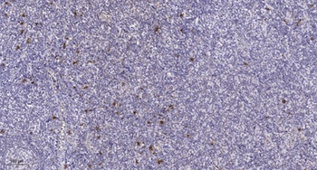 IGSF4B rabbit pAb Antibody