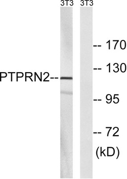PTP IA-2β rabbit pAb Antibody