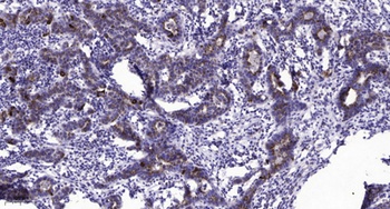 PTP IA-2β rabbit pAb Antibody