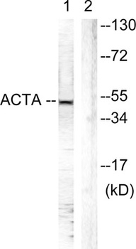 Actin-α/γ rabbit pAb Antibody