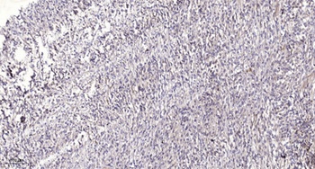 Rad23A rabbit pAb Antibody