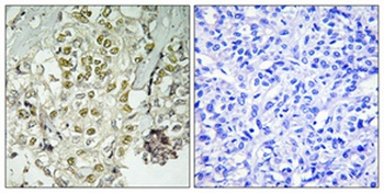 Rad51D rabbit pAb Antibody