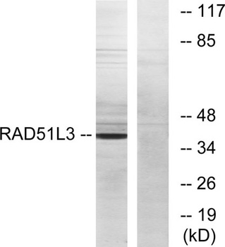 Rad51D rabbit pAb Antibody