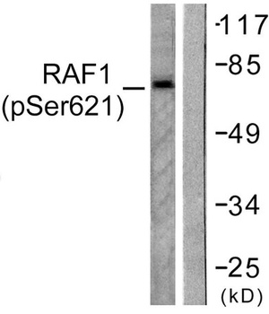 Raf-1 (phospho Ser621) rabbit pAb Antibody
