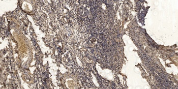 Rap 2B rabbit pAb Antibody