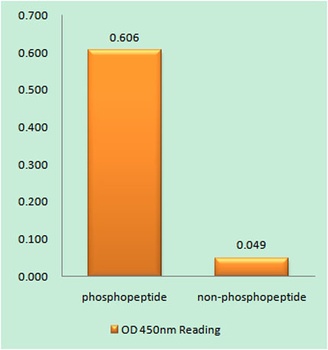 Rb (phospho Ser811) rabbit pAb Antibody