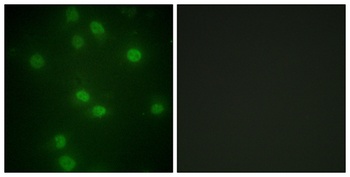 Rb (phospho Ser811) rabbit pAb Antibody